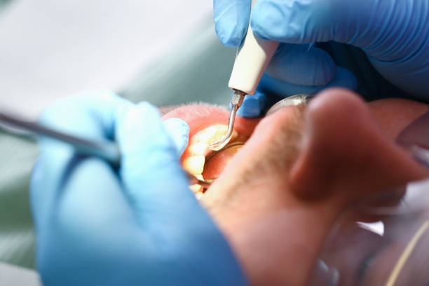 Best Urgent Care for Lost Fillings or Crowns in Jeannette, PA